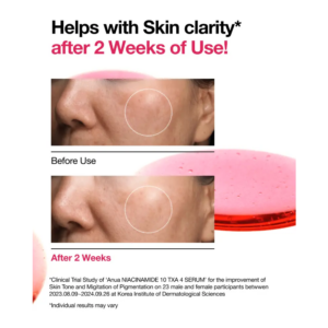 Alternative view of Anua Sérum Anti-Taches Niacinamide 10 % + TXA 4 % : Éclat & Correction – 30 ml