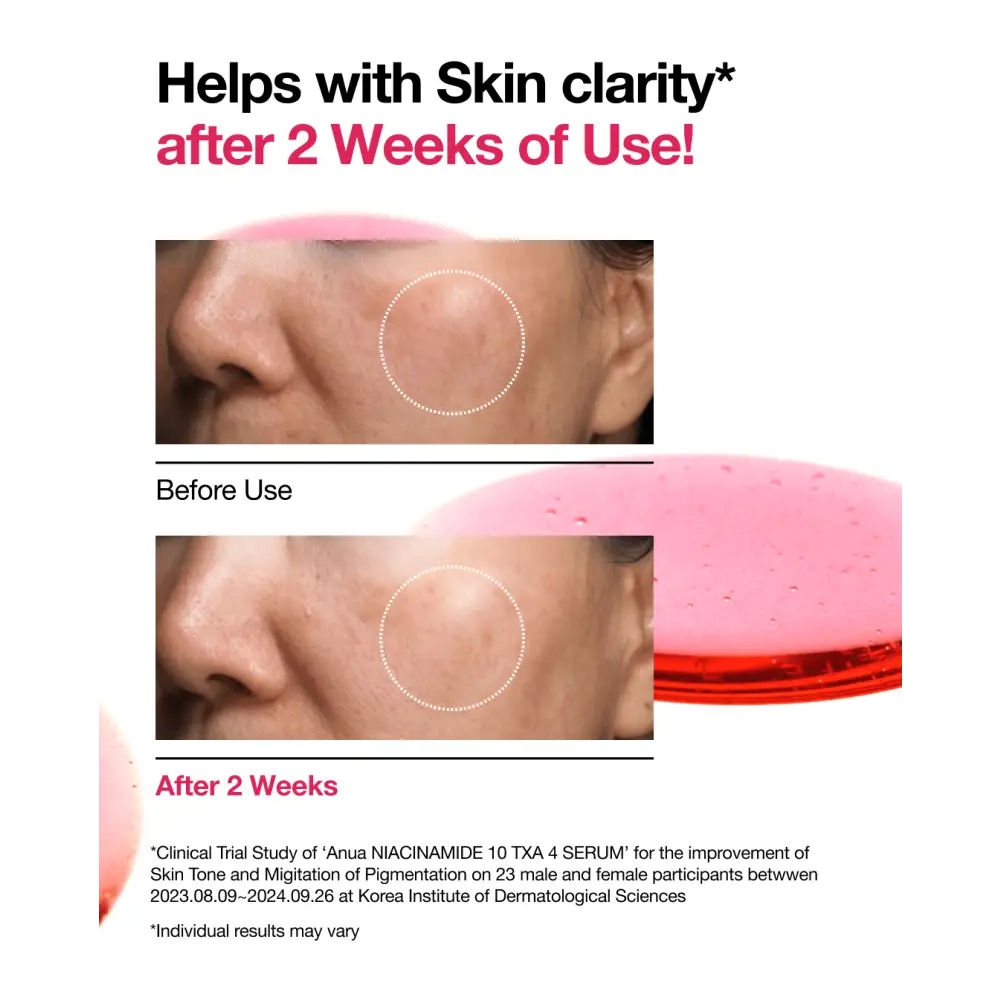 Anua Sérum Anti-Taches Niacinamide 10 % + TXA 4 % : Éclat & Correction – 30 ml – Image 2