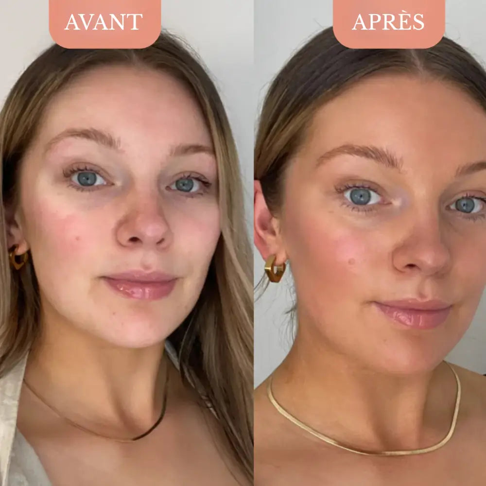 Set Mousse Bronzante Instantanée | Skinovaa Dark Tanning – Image 16