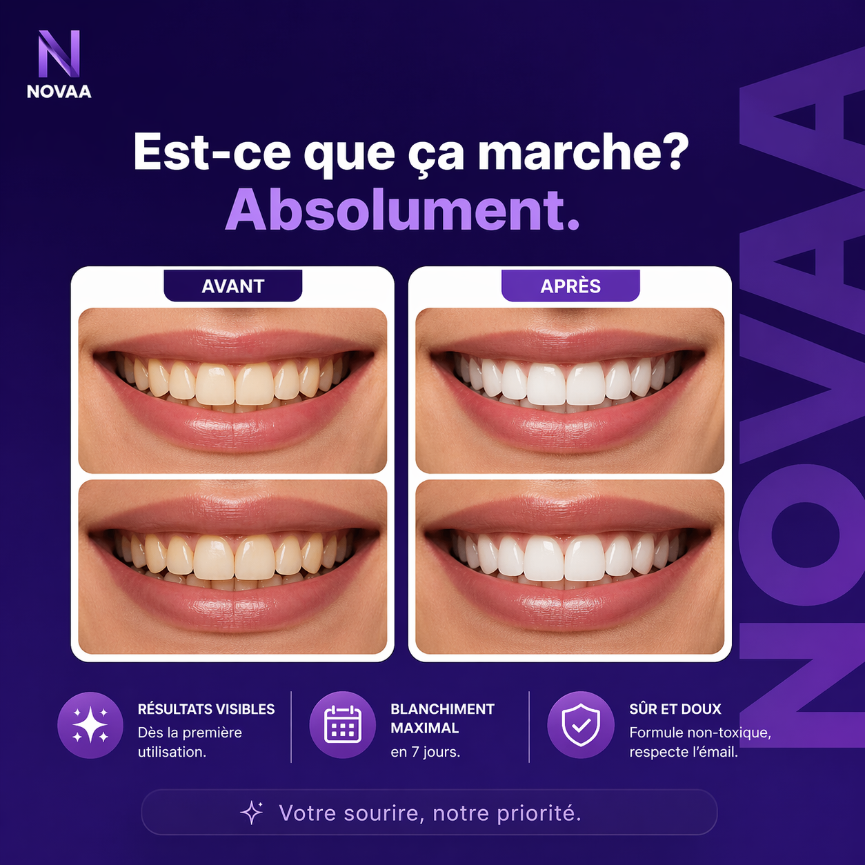 Bandes de Blanchiment Dentaire – Image 3