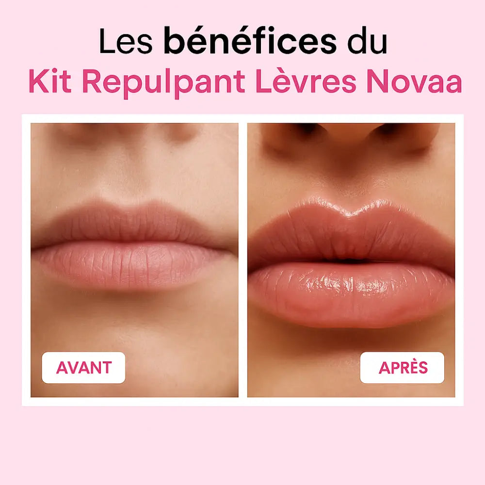 Kit Repulpant Lèvres Skinovaa – Lip Boost Naturel – Image 4