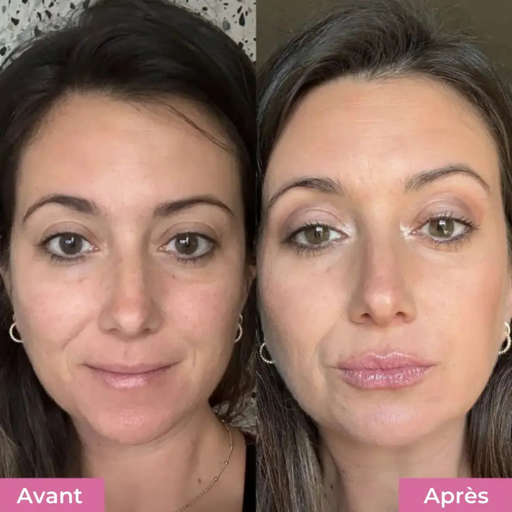 Kit Repulpant Lèvres Skinovaa – Lip Boost Naturel – Image 3